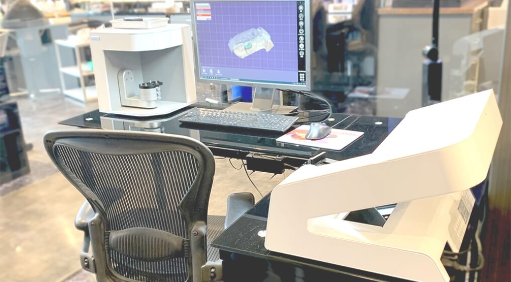 インプラントの特徴